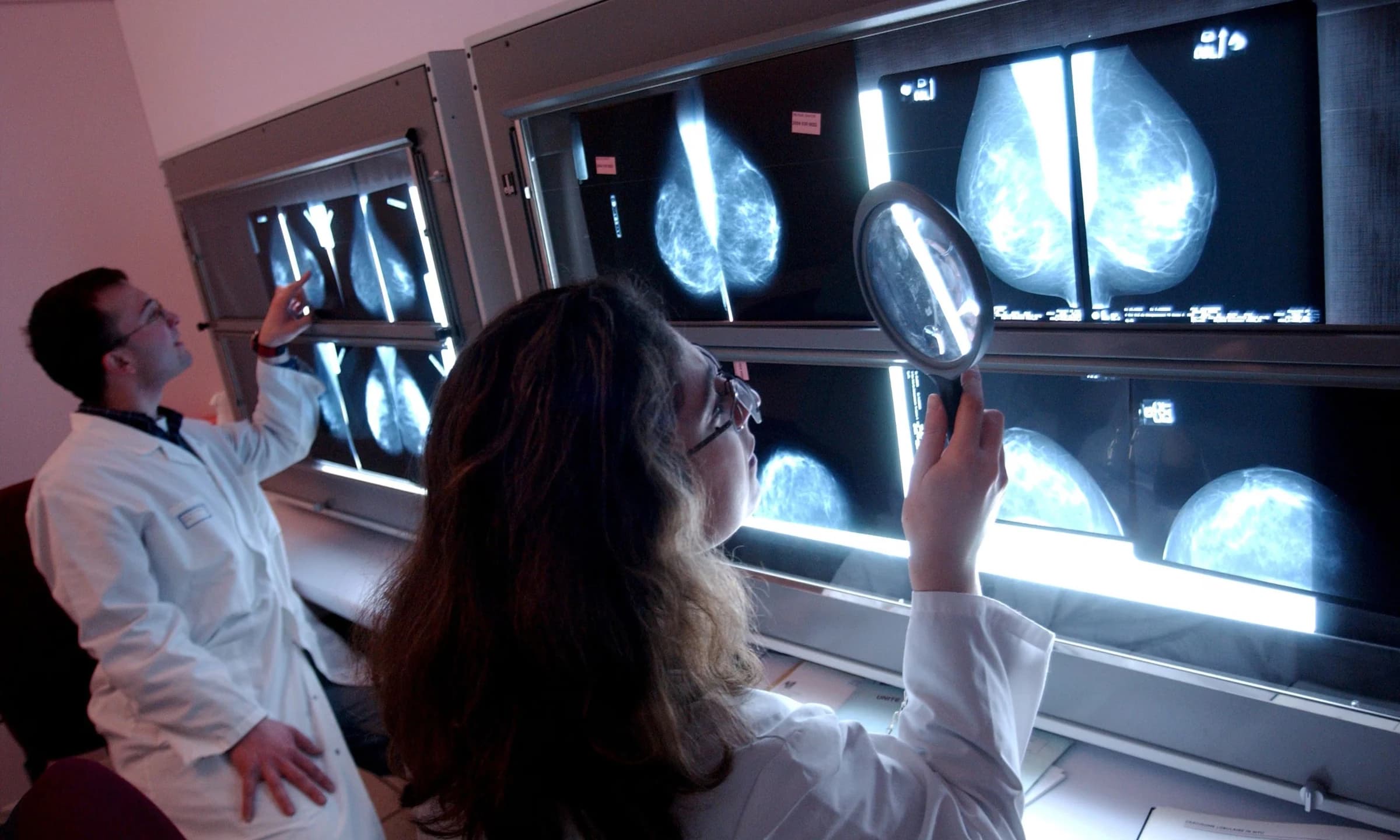 Two radiologists independently reviewing mammogram films — the double-reading standard at the centre of NHS breast screening
